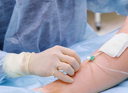 Vascular surgery